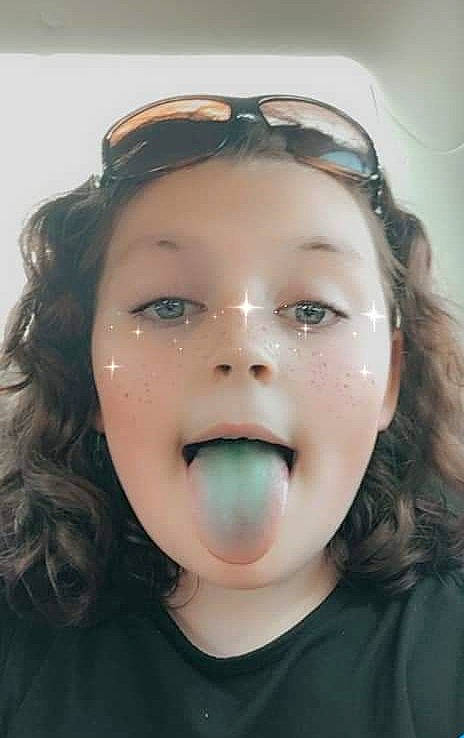 Abagail joined the competition — help win amazing prizes! cheek, chewing_gum, child, chin, face, facial_expression, forehead, fun, head, jaw, lip, mouth, nose, organ, person, selfie, skin, smile, snack, surprise