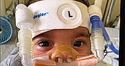 Delilah is registered to the contest to win money with this photo: baby, child, medical_device, breathing_apparatus, hospital, headband, pigtails, hair_ties, closeup, infant, face, curious, indoors, person, young_child, healthcare, equipment, cute, patient, hospital_room