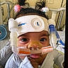 baby, child, medical_device, breathing_apparatus, hospital, headband, pigtails, hair_ties, closeup, infant, face, curious, indoors, person, young_child, healthcare, equipment, cute, patient, hospital_room