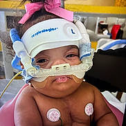 Delilah is registered to the contest to win money with this photo: baby, infant, pink_bow, respiratory_mask, medical_equipment, hospital, monitoring_pads, child, person, cute, healthcare, medical_care, baby_seat, face, closeup, skin, cute_expression, indoor, patient, treatment