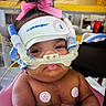 baby, infant, pink_bow, respiratory_mask, medical_equipment, hospital, monitoring_pads, child, person, cute, healthcare, medical_care, baby_seat, face, closeup, skin, cute_expression, indoor, patient, treatment