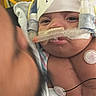 Delilah is registered to the contest to win money with this photo: baby, infant, medical_tubes, hospital, healthcare, patient, monitoring, person, face, child, medical_equipment, headband, adult, blurred_face, skin, hand, hospital_bed, newborn, medical_care, closeup