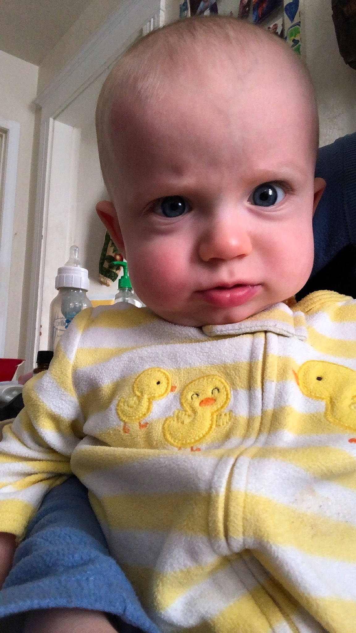 Ivar is registered to the contest to win money with this photo: baby, cheek, child, eye, face, head, nose, person, skin, toddler, yellow