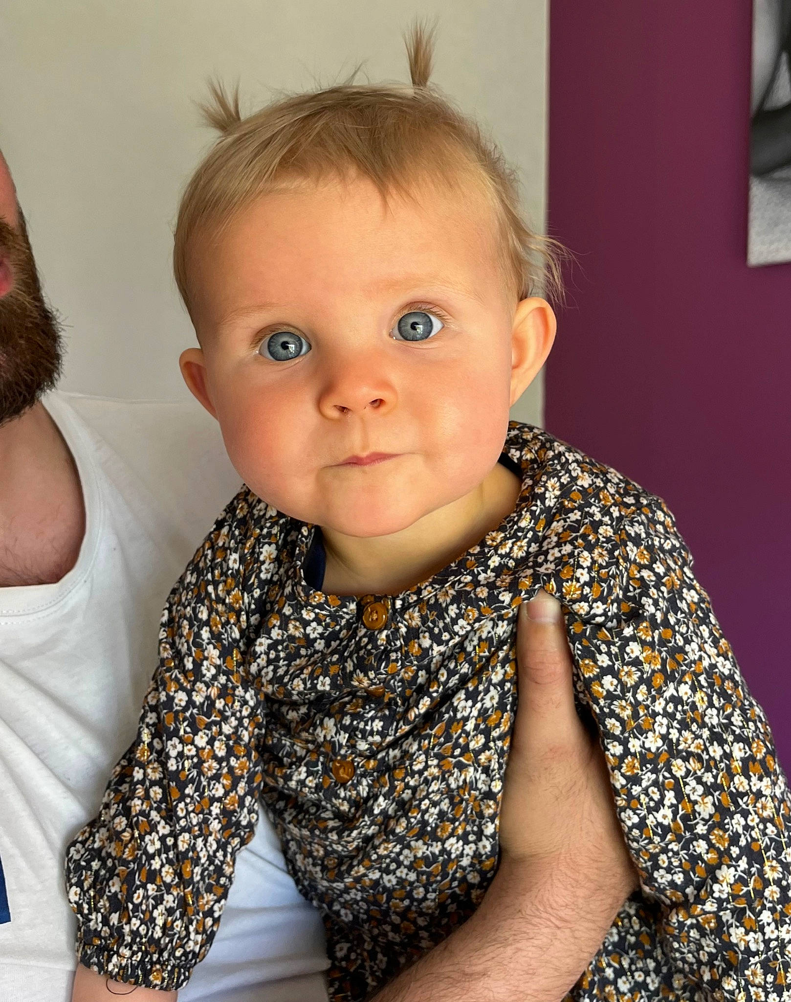 Mia a rejoint le concours — aidez-le/la à gagner de superbes lots ! arm, baby_toddler_clothing, cheek, chin, ear, eye, eyelash, face, facial_expression, hair, human_body, iris, joint, lip, neck, nose, person, product, shoulder, skin