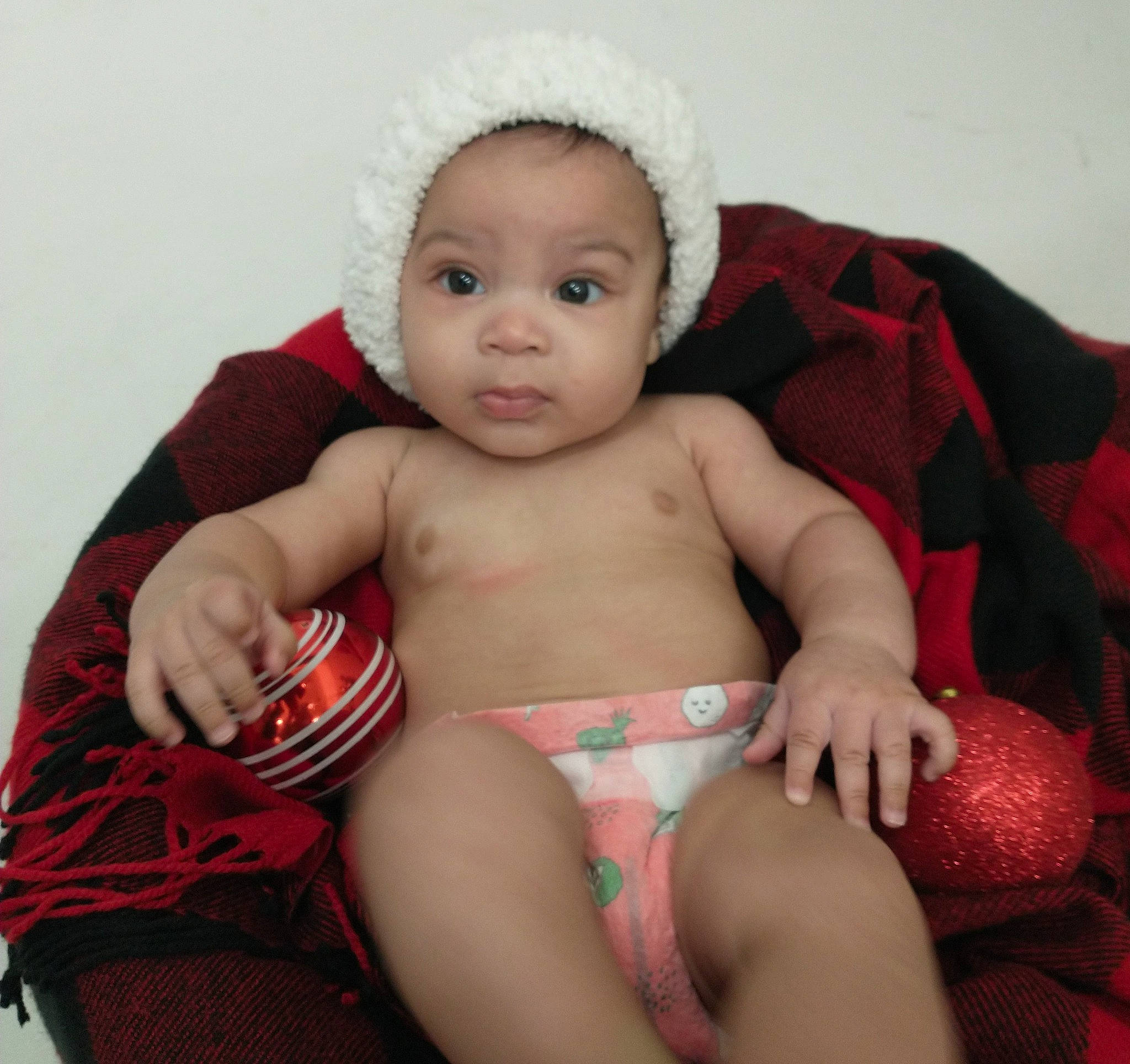 Cash joined the competition — help win amazing prizes! arm, baby, baby_toddler_clothing, cheek, comfort, eye, human_body, iris, knee, leg, lip, mammal, mouth, muscle, neck, organ, person, product, skin, stomach