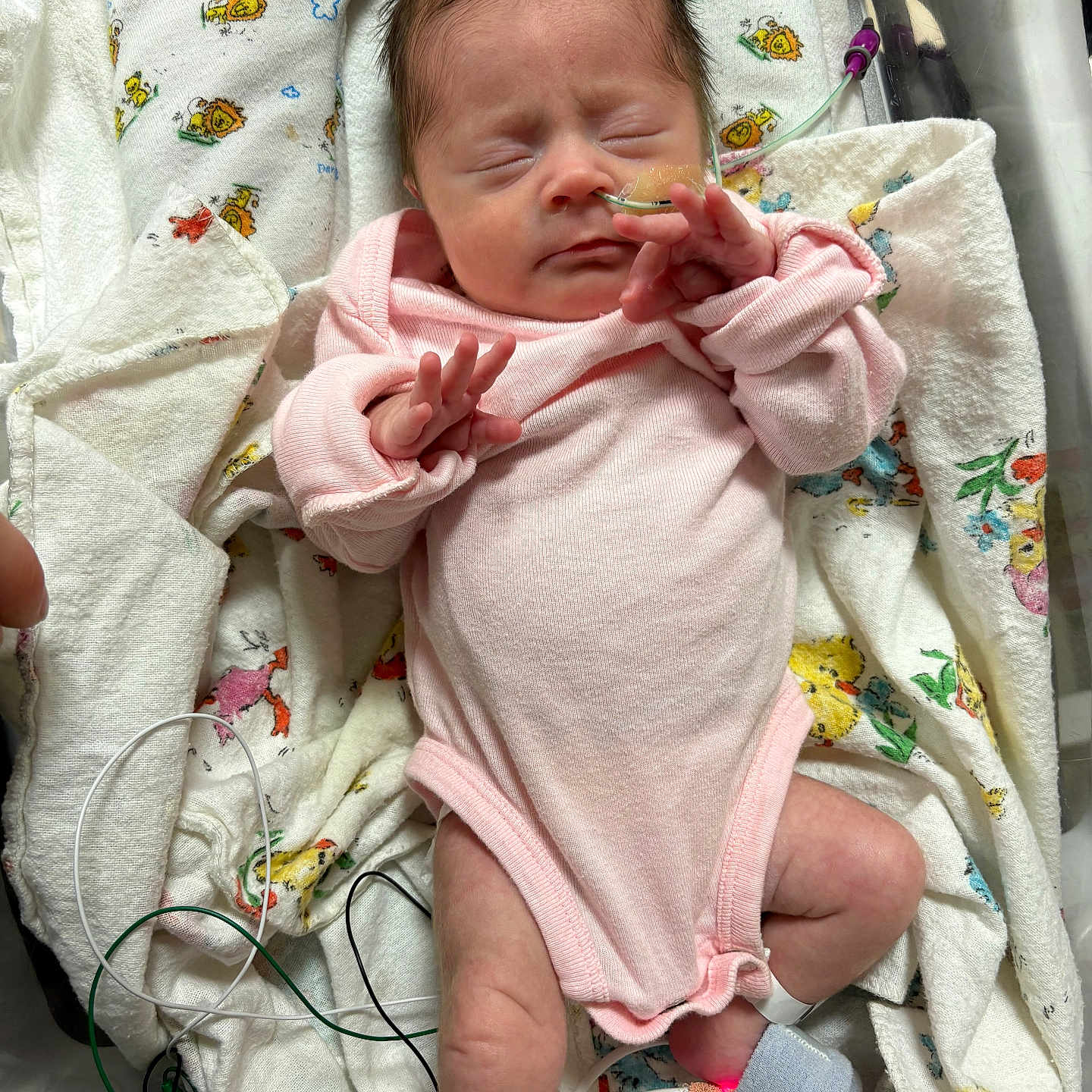 Kingsley is registered to the contest to win money with this photo: animal_pattern, baby, blanket, cute, face, foot, fragile, hand, healthcare, hospital, infant, lying_down, medical_care, monitoring_wires, nasal_tube, newborn, patient, pink_onesie, sleeping, small