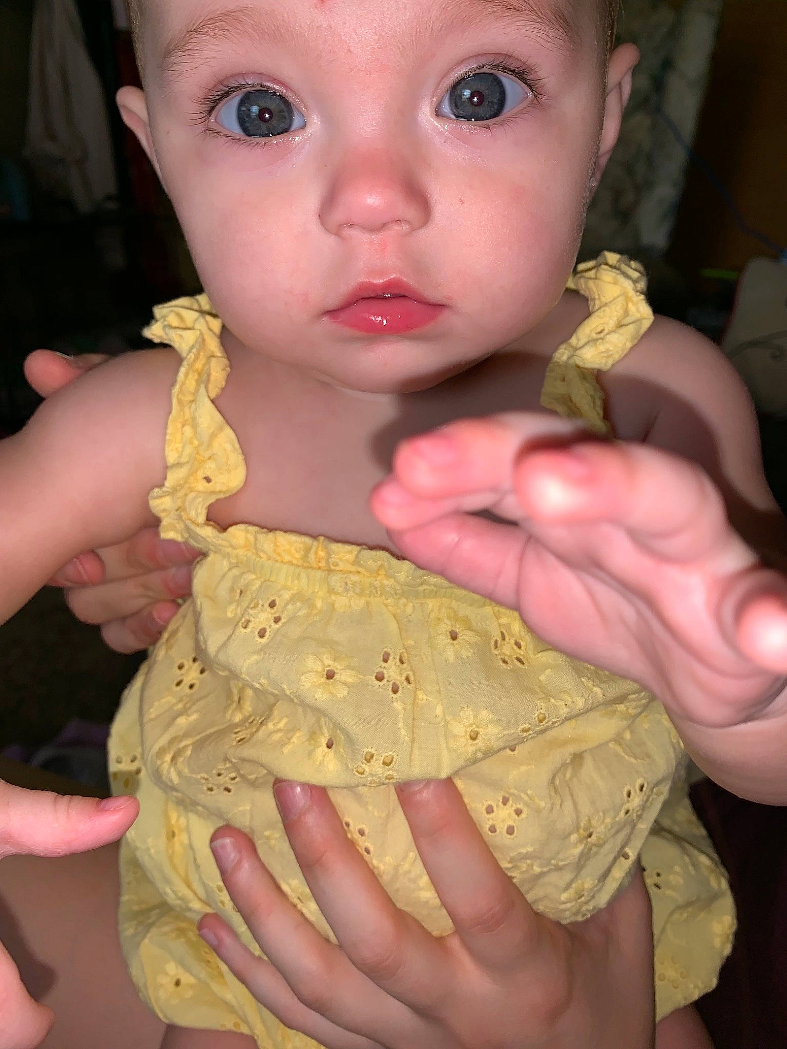 Journey Marie is registered to the contest to win money with this photo: cheek, child, finger, hand, lip, nail, neck, person, skin, thumb, toddler