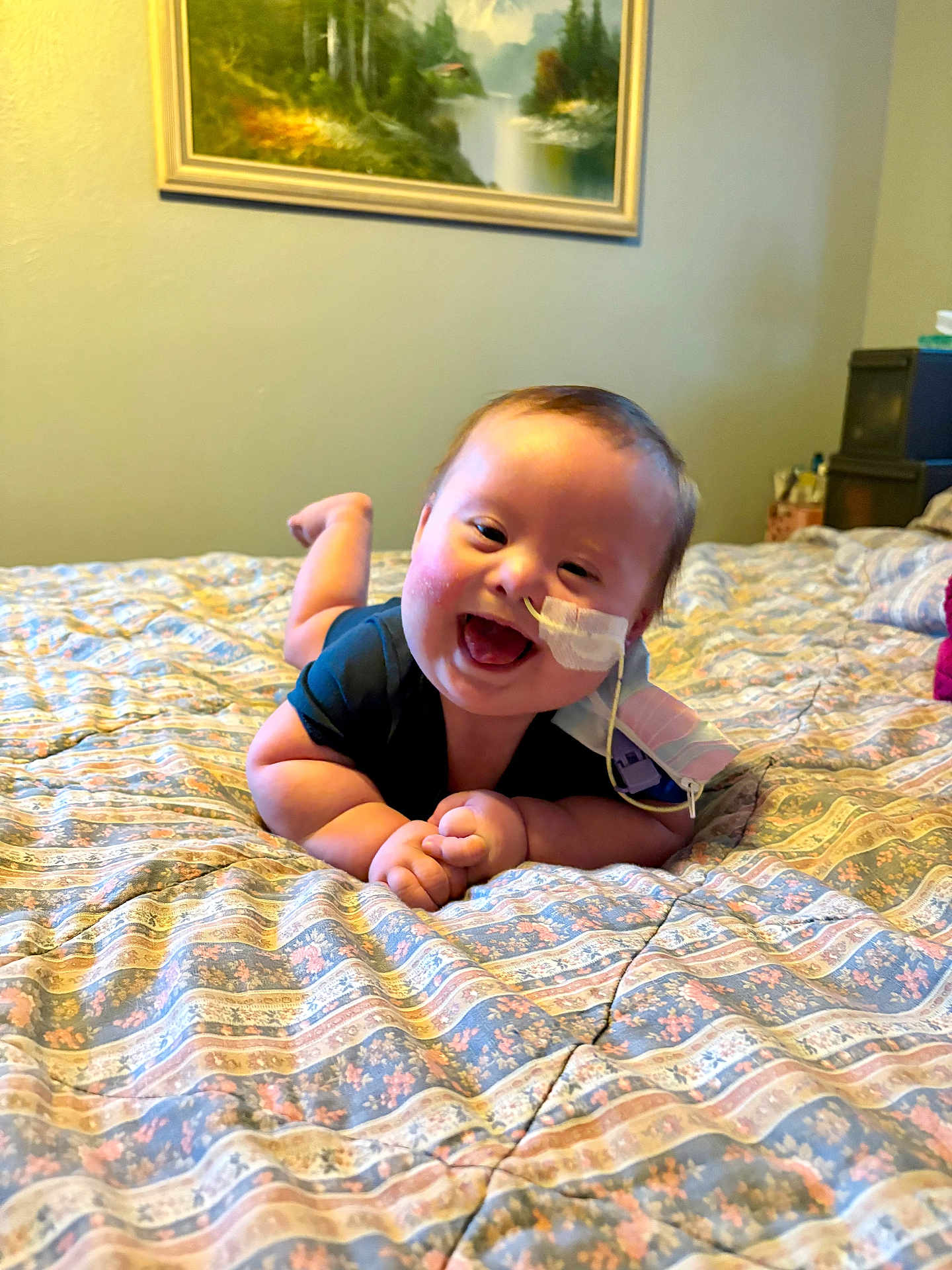Ezekiel joined the competition — help win amazing prizes! baby, smiling, feeding_tube, bed, blanket, patterned, indoor, wall, painting, person, child, happy, face, lying_down, healthcare, medical, comfort, home, cute, infant