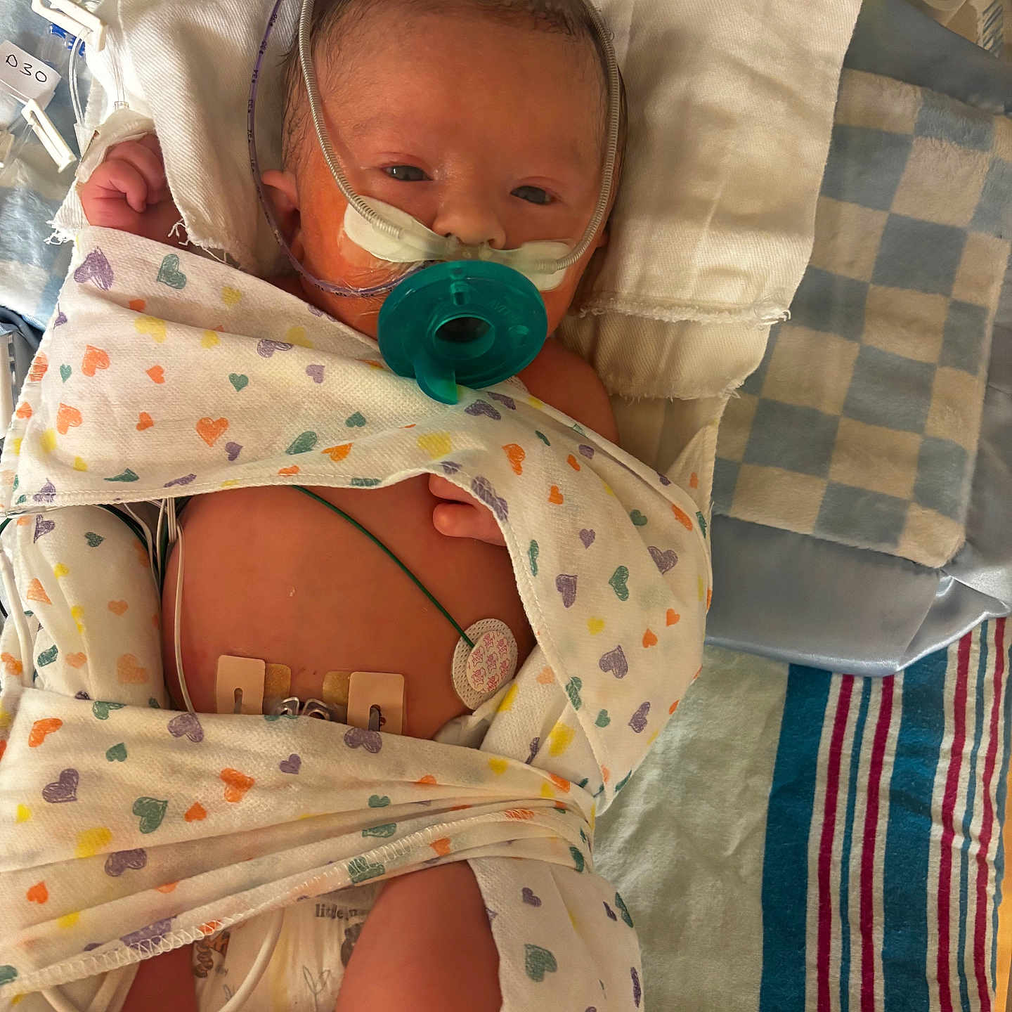 Fisher joined the competition — help win amazing prizes! newborn, baby, hospital, medical_tubes, blanket, heart_pattern, sensor, pacifier, bed, infant, swaddled, monitoring, healthcare, patient, cute, resting, child, person, soft, medical_care