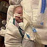 Lily joined the competition — help win amazing prizes! infant, baby, hospital, medical_tubes, blanket, swaddled, sleeping, face, person, healthcare, bed, patient, monitoring, medical_equipment, nasal_cannula, quiet, resting, newborn, care, pediatric