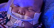 Lily is registered to the contest to win money with this photo: baby, sleeping, medical_tube, blanket, striped_clothing, face, head, infant, medical_tape, closeup, indoors, portrait, child, healthcare, resting, cozy, blue_light, soft_lighting, person, peaceful