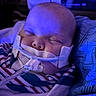 baby, sleeping, medical_tube, blanket, striped_clothing, face, head, infant, medical_tape, closeup, indoors, portrait, child, healthcare, resting, cozy, blue_light, soft_lighting, person, peaceful