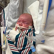 Lily is registered to the contest to win money with this photo: newborn, baby, hospital, medical_equipment, breathing_tube, blanket, crib, swaddled, infant, face, person, healthcare, monitoring, medical_tubing, patient, bed, white_cloth, striped_blanket, closeup, indoors