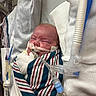 newborn, baby, hospital, medical_equipment, breathing_tube, blanket, crib, swaddled, infant, face, person, healthcare, monitoring, medical_tubing, patient, bed, white_cloth, striped_blanket, closeup, indoors