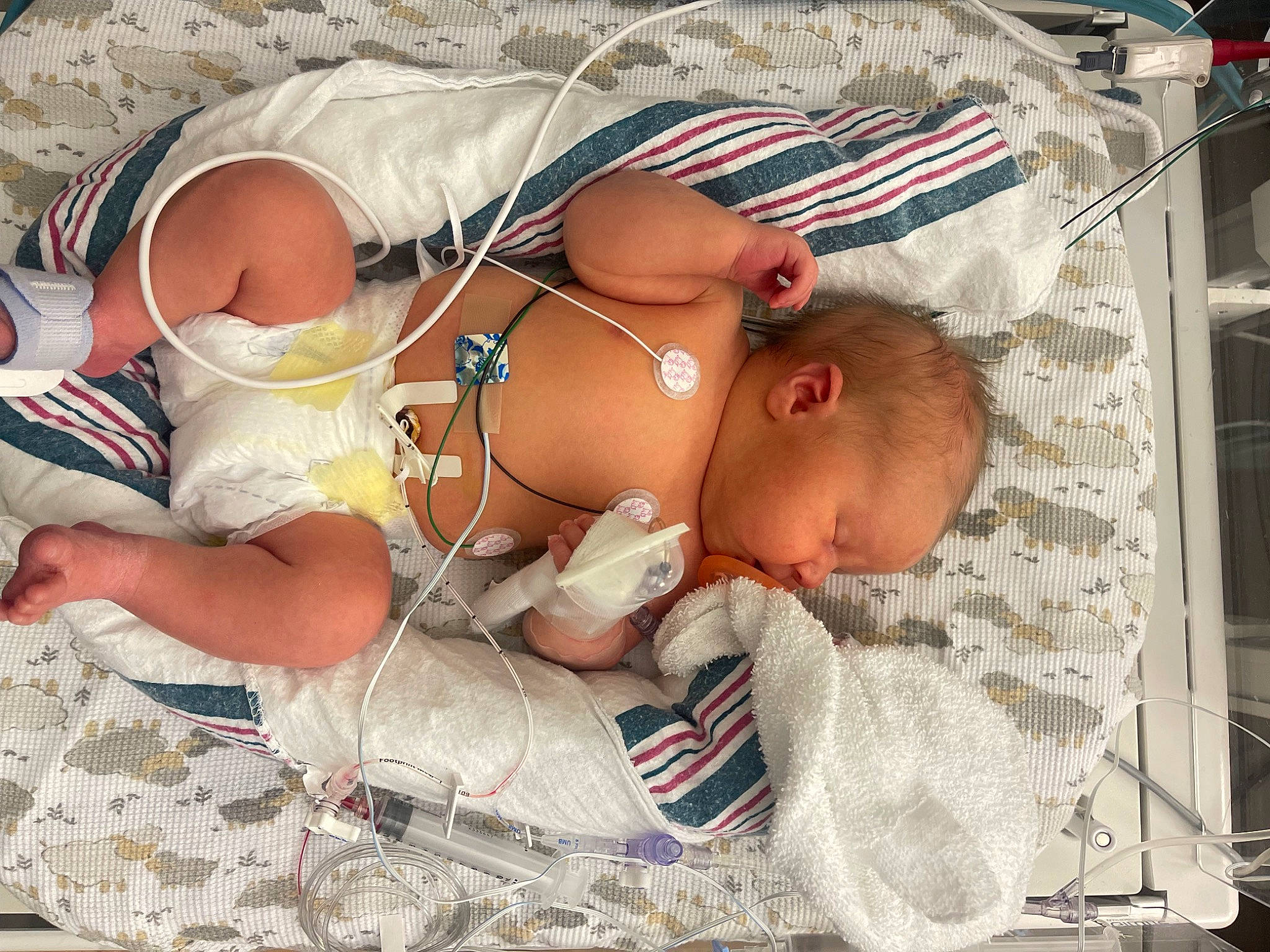 Andrew is registered to the contest to win money with this photo: abdomen, baby, baby_products, baby_toddler_clothing, barechested, brassiere, chest, child, comfort, diaper, event, hospital, human_leg, linens, navel, person, stomach, thigh, toddler, trunk