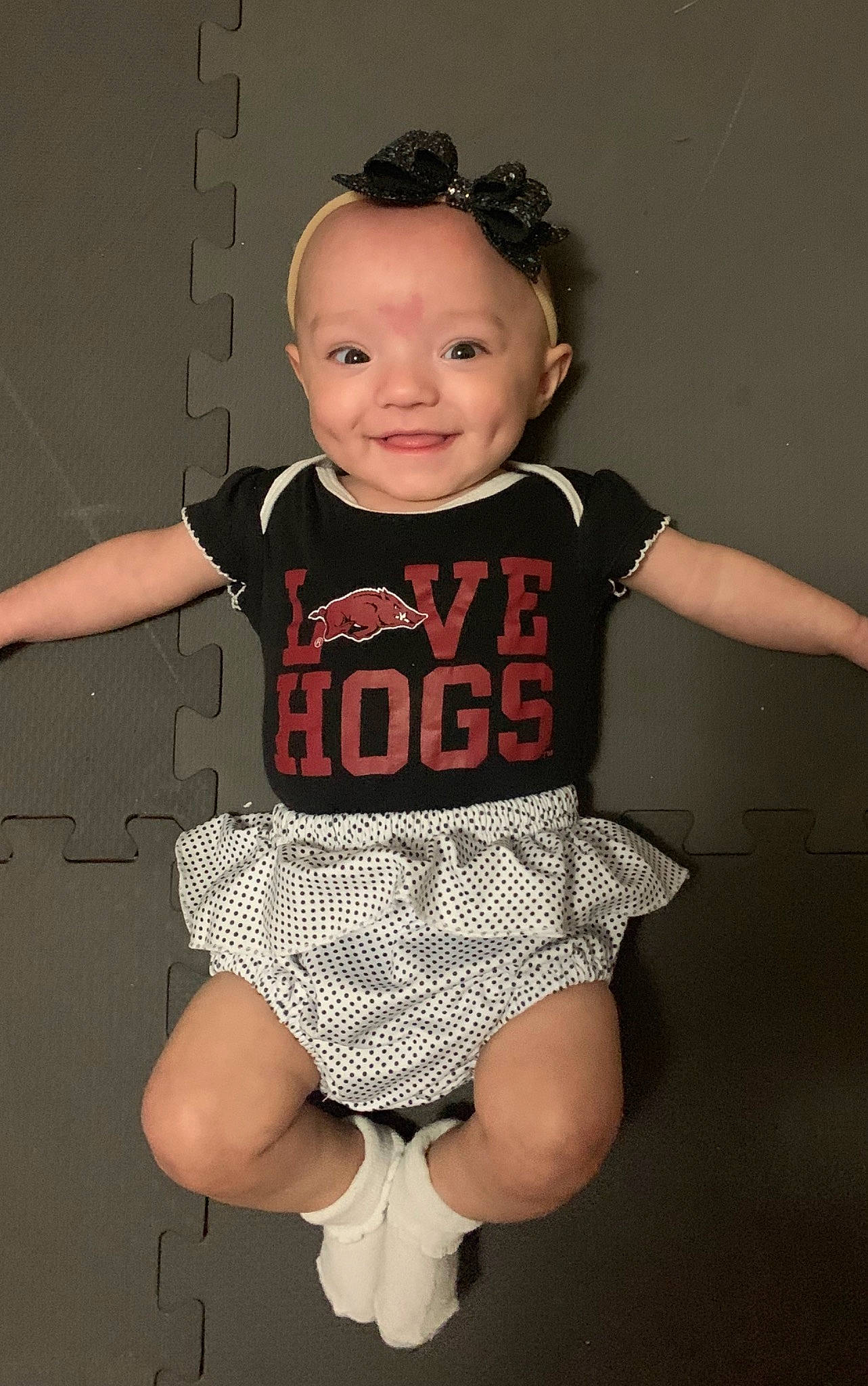 Emmalynn is registered to the contest to win money with this photo: arm, baby, baby_products, baby_toddler_clothing, cheek, child, child_model, clothing, design, joint, joy, leg, pattern, person, pink, product, skin, sleeve, standing, t_shirt