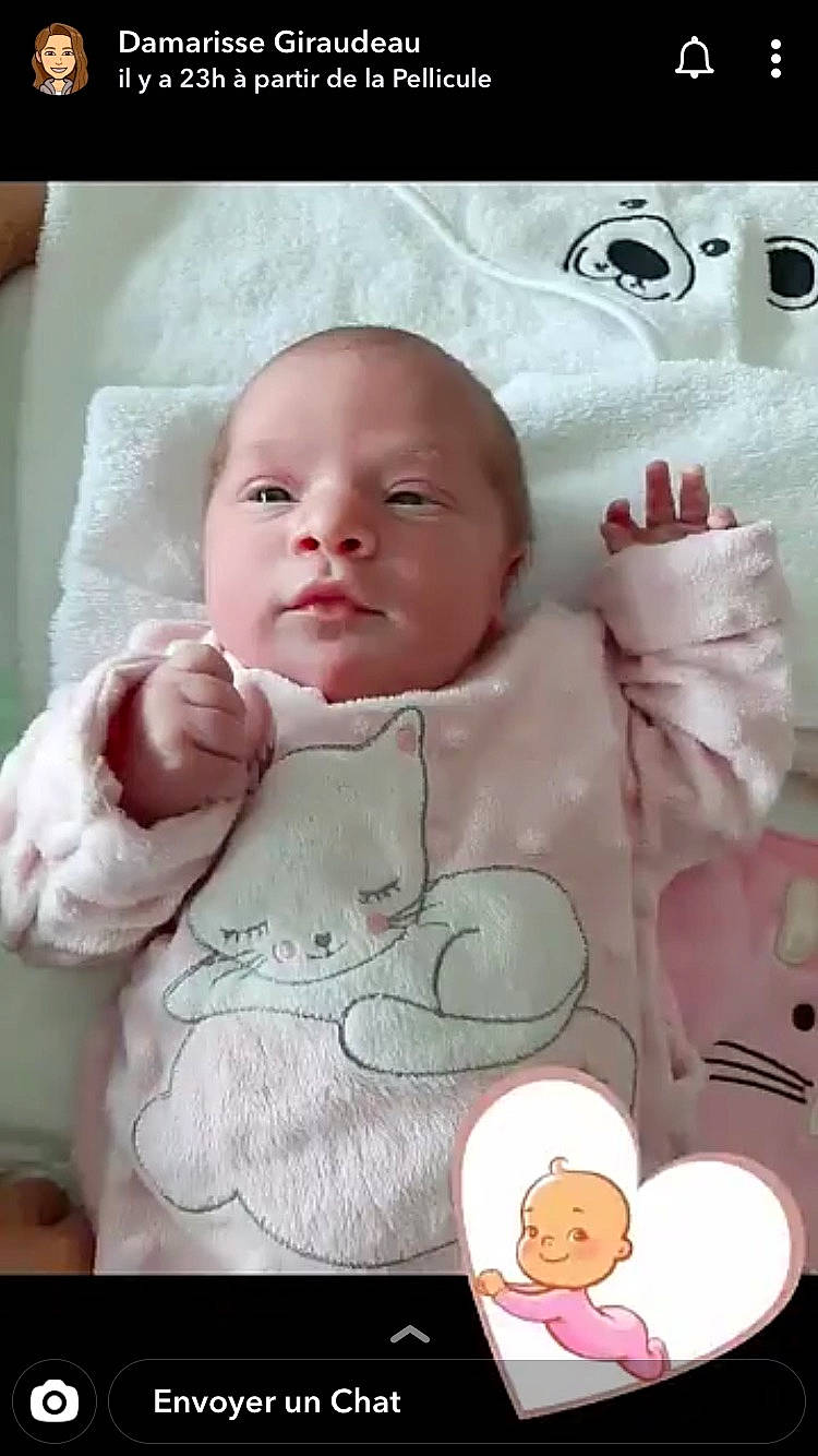 Joye participe au concours pour gagner de l'argent avec cette photo : baby, baby_products, baby_safety, bedtime, birth, cheek, child, childbirth, head, mouth, nose, person, product, skin, toddler