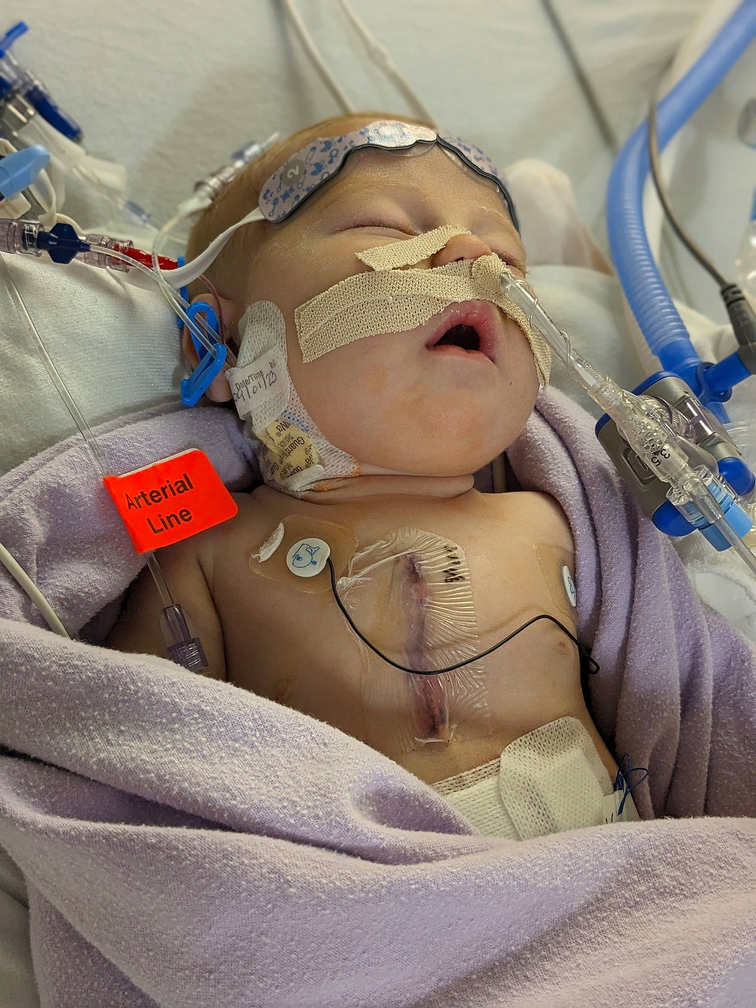 Saili is registered to the contest to win money with this photo: abdomen, baby, baby_products, baby_sleeping, chest, child, comfort, event, hat, health_care, hospital, hospital_bed, linens, medical_equipment, medical_procedure, patient, person, service, smile, sunglasses