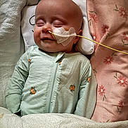 Monroe is registered to the contest to win money with this photo: baby, bed, blanket, child, comfort, cute, face, feeding_tube, floral_pattern, healthcare, indoors, infant, medical_tube, onesie, peaceful, pillow, resting, skin, sleeping, toddler