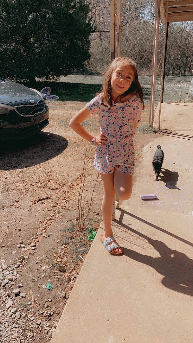 Zyriah is registered to the contest to win money with this photo: asphalt, automotive_lighting, automotive_tire, fawn, grass, headlamp, hood, human_leg, joy, leg, leisure, motor_vehicle, person, personal_luxury_car, recreation, road, road_surface, sandal, sidewalk, thigh