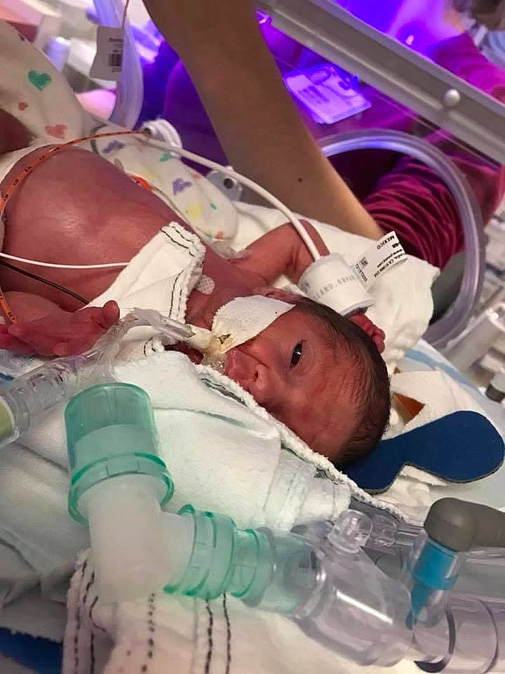 Vannessa joined the competition — help win amazing prizes! baby, baby_toddler_clothing, child, comfort, event, health_care, hospital, hospital_bed, human_body, medical, medical_equipment, medical_procedure, mouth, patient, person, purple, service, skin, snapshot, toddler