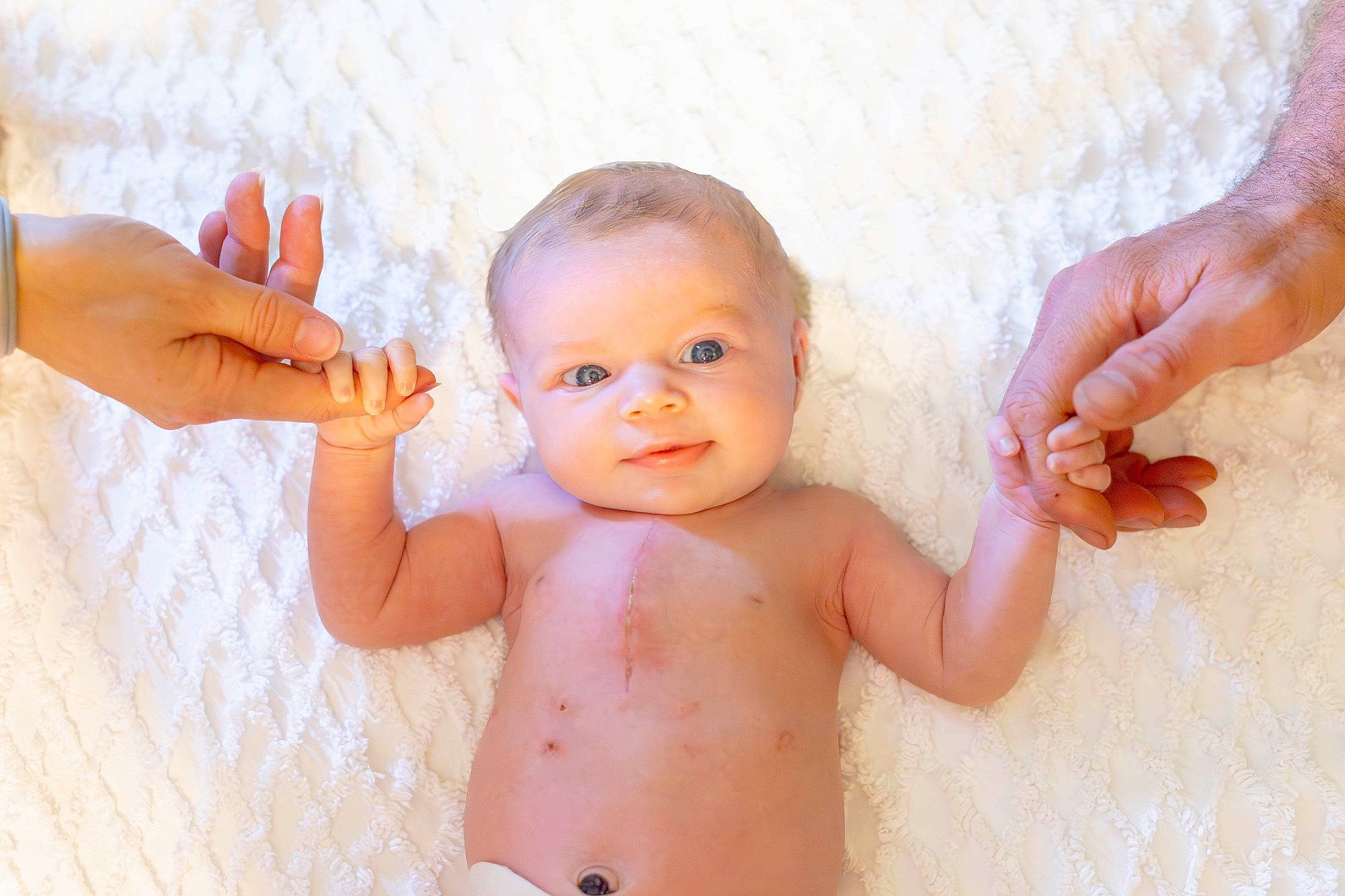 Ayla joined the competition — help win amazing prizes! arm, baby, cheek, eyelash, finger, gesture, hand, happy, head, human_body, joint, leg, muscle, nail, organ, person, pink, skin, stomach, thumb