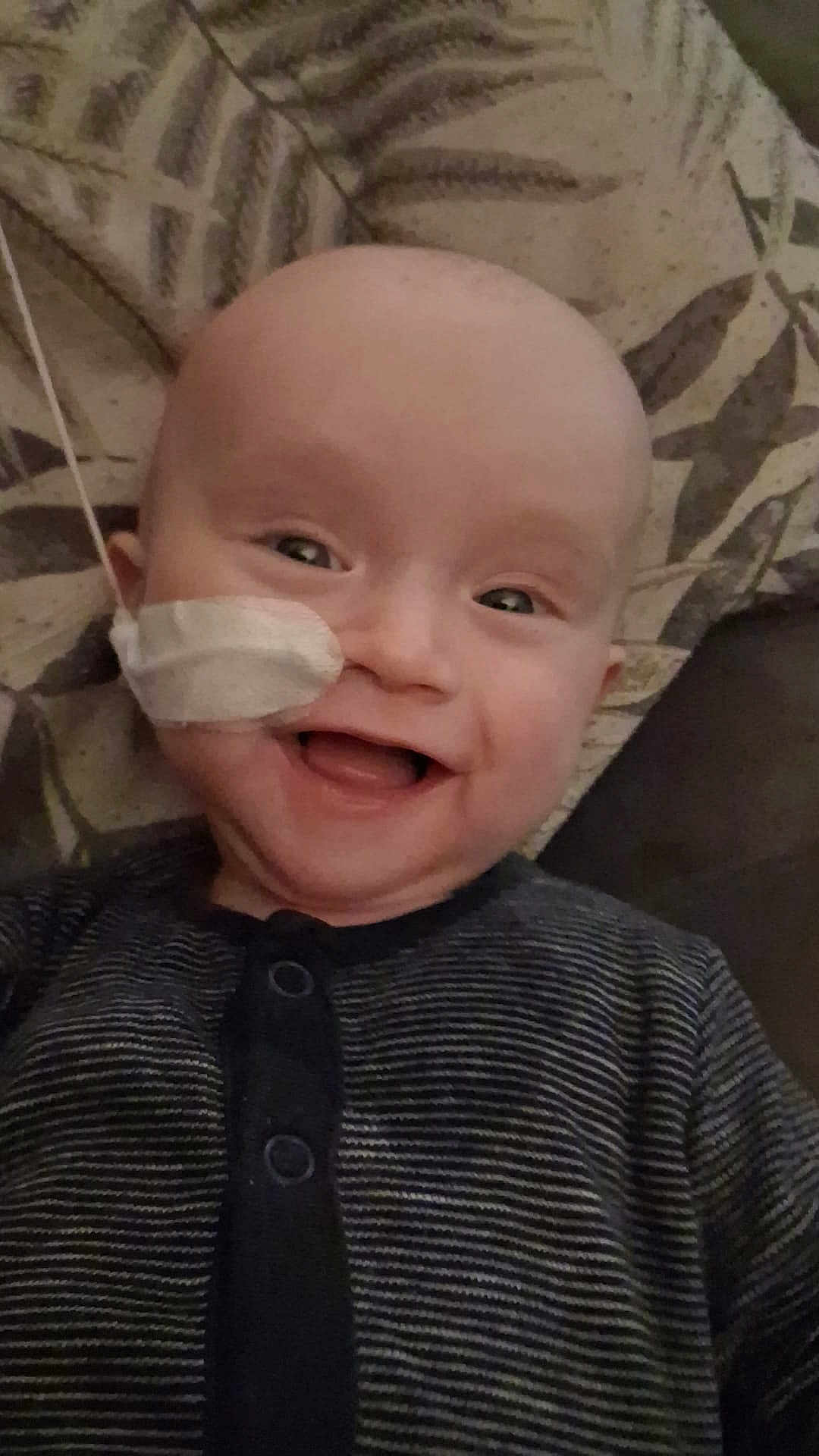 Flynn is registered to the contest to win money with this photo: baby, smiling, face, nasaltube, lyingdown, striped_clothing, pillow, infant, happy, child, cute, healthcare, medical, indoors, person, portrait, head, skin, eyes, mouth
