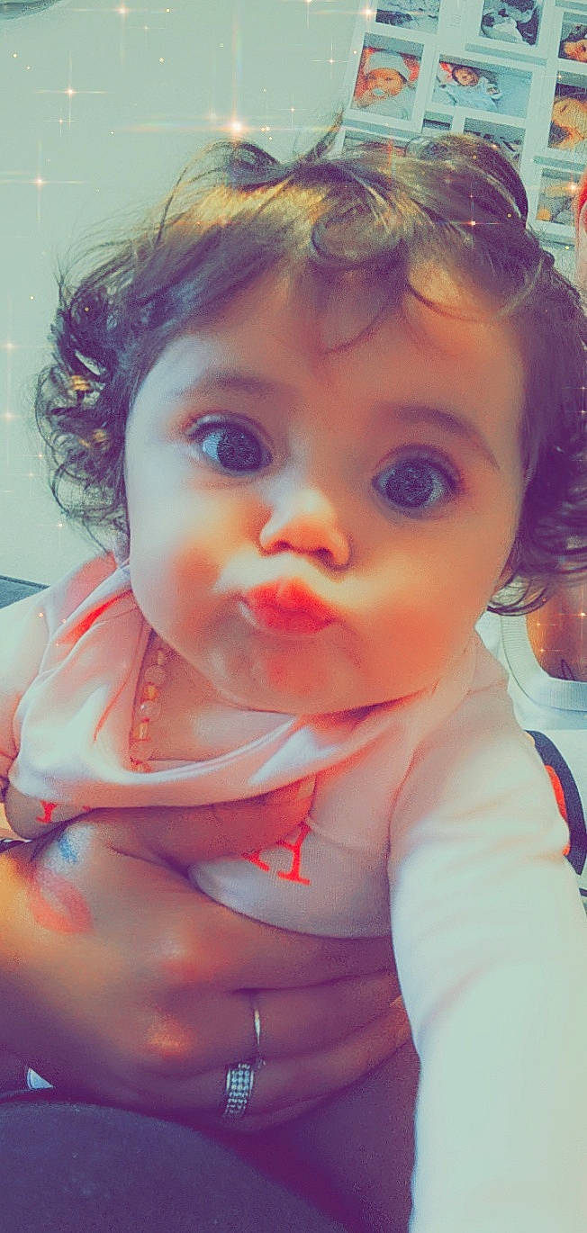 Catalèya participe au concours pour gagner de l'argent avec cette photo : baby, baby_toddler_clothing, cheek, chin, dress, ear, eye, eyelash, forehead, grass, hair, happy, human_body, iris, lip, mouth, nose, person, skin, smile