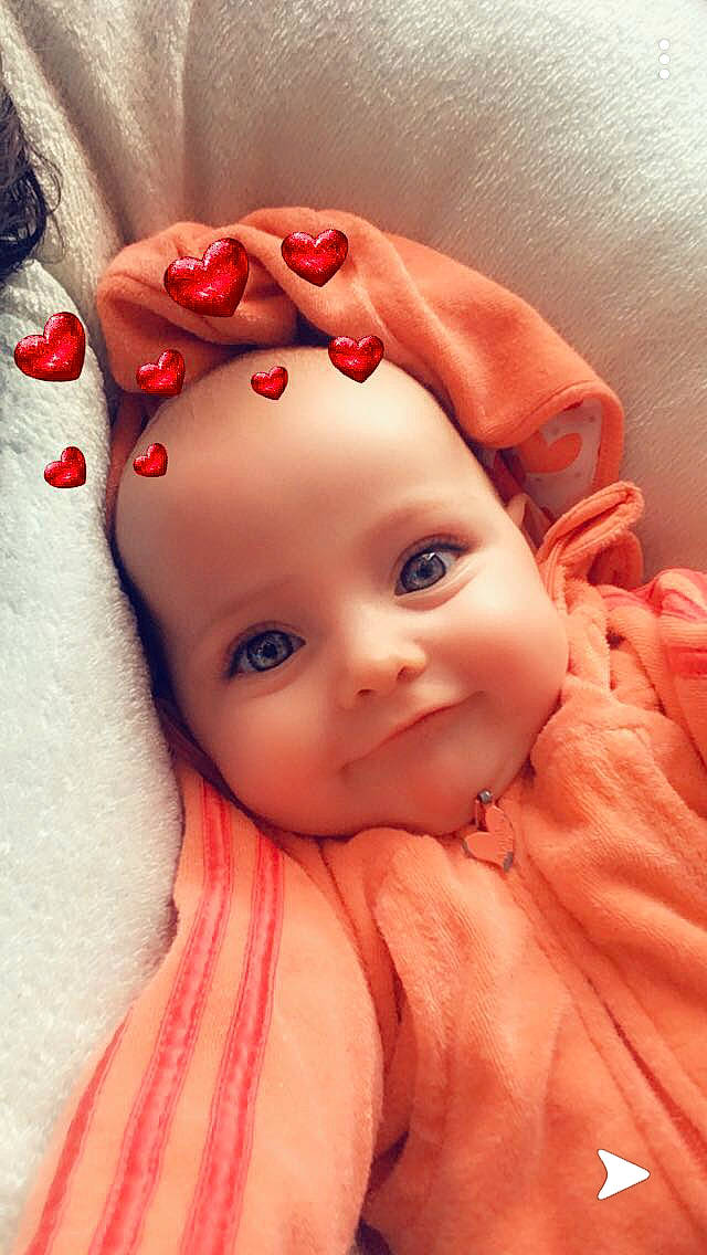 Alba a rejoint le concours — aidez-le/la à gagner de superbes lots ! baby, cheek, child, close_up, ear, eye, face, hair_accessory, head, lip, mouth, nose, person, photography, pink, red, skin, toddler