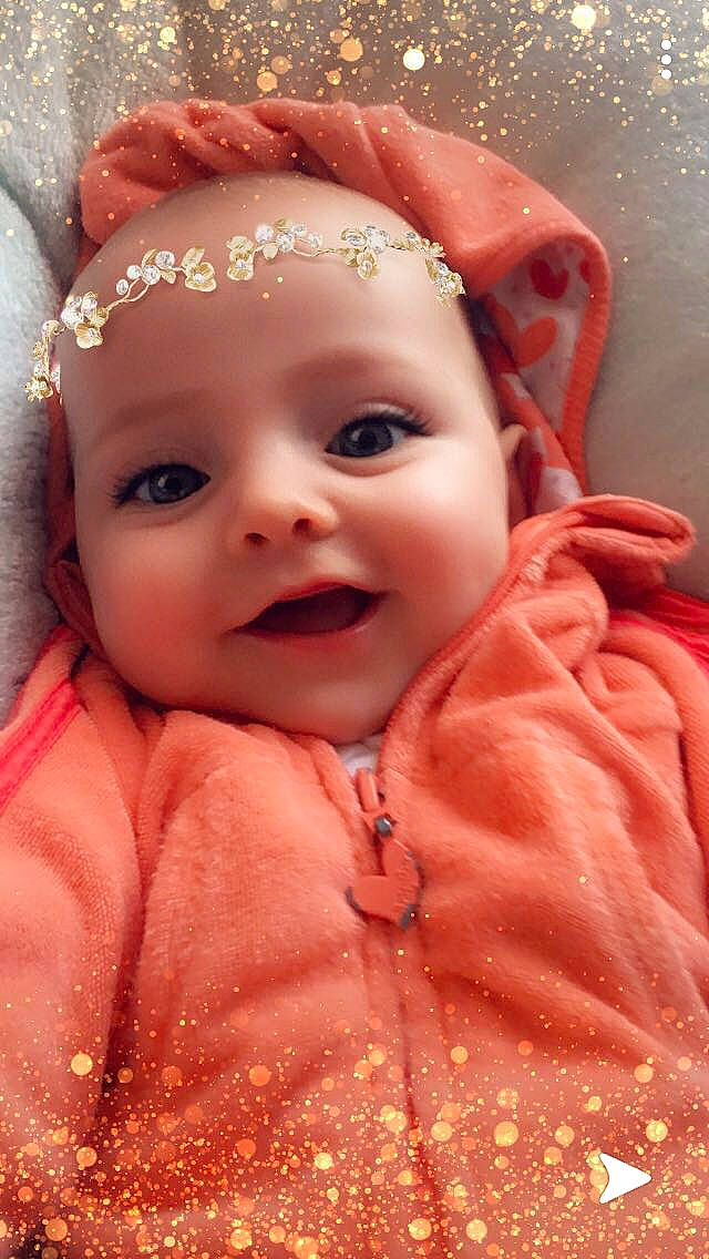 Alba a rejoint le concours — aidez-le/la à gagner de superbes lots ! baby, cheek, child, close_up, eye, eyebrow, face, forehead, hair_accessory, head, headgear, iris, lip, mouth, nose, peach, person, pink, skin, smile