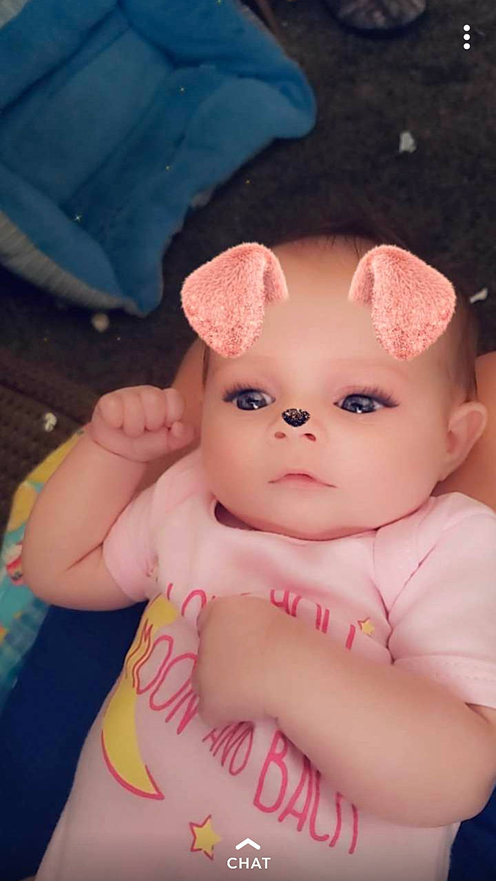 Lizzy joined the competition — help win amazing prizes! baby, cheek, child, ear, eye, face, forehead, head, iris, lip, person, pink, skin, toddler