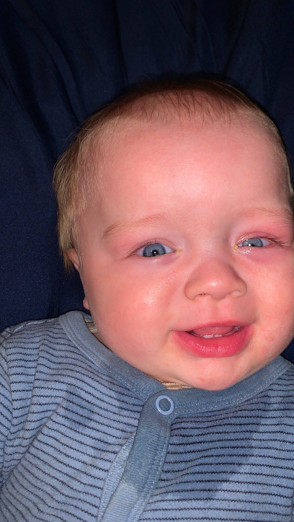 Mathew joined the competition — help win amazing prizes! baby, baby_toddler_clothing, cheek, chin, clothing, ear, eyebrow, eyelash, flash_photography, forehead, human_body, iris, jaw, lip, mouth, nose, organ, person, skin, sleeve