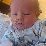 Waylon joined the competition — help win amazing prizes! baby, infant, newborn, face, feeding_tube, nasal_tube, onesie, dinosaur_print, pajamas, cheeks, eyes, close_up, portrait, hands, blanket, soft_lighting, indoor, sitting, medical_tape, sleepy