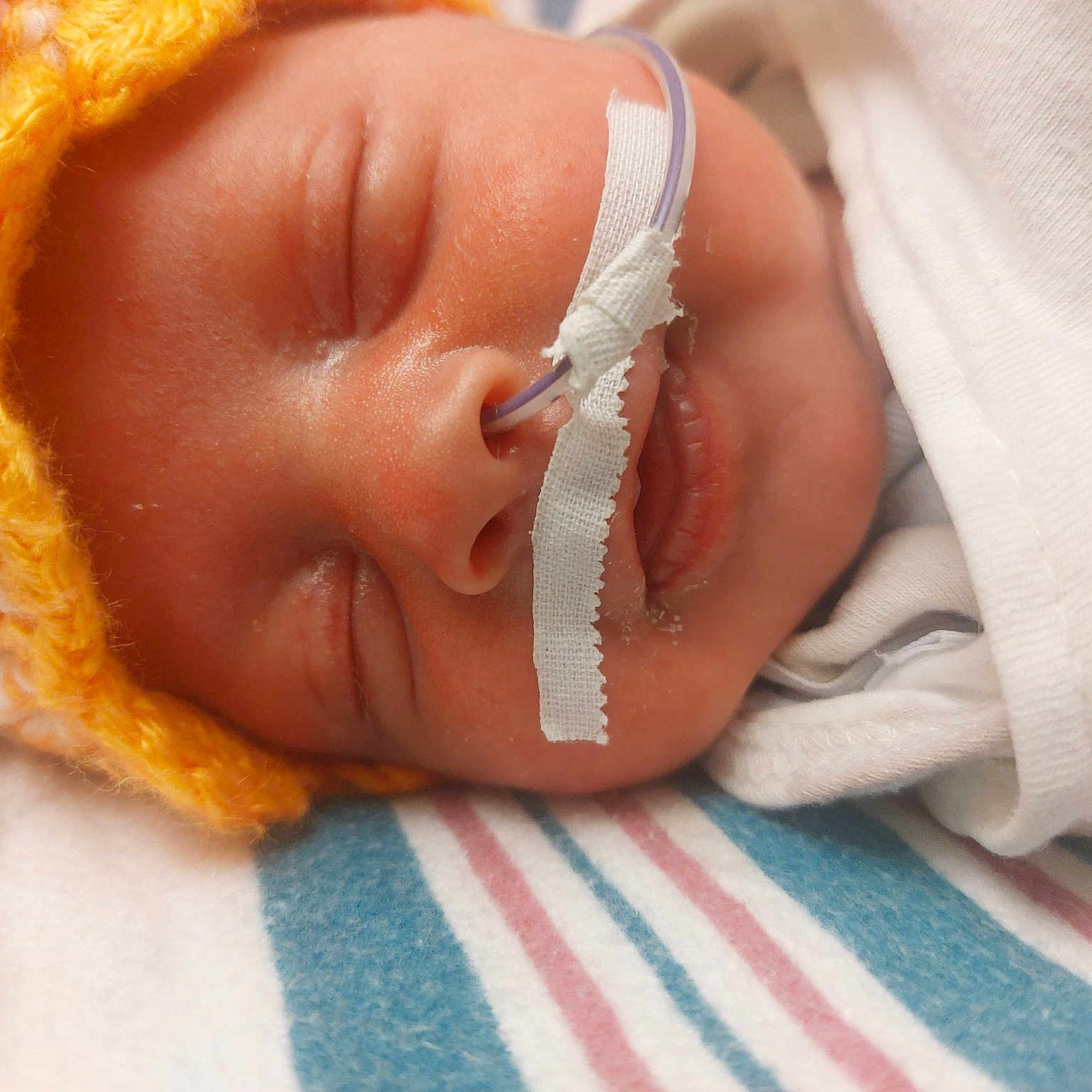 Storm joined the competition — help win amazing prizes! arm, baby, baby_sleeping, comfort, eye, eyebrow, eyelash, hand, happy, hat, head, headgear, human_body, iris, lip, nail, neck, nose, thumb, toddler