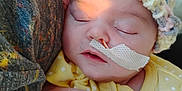 Rosie joined the competition — help win amazing prizes! baby, sleeping, hat, crochet, yellow_clothing, polka_dot, nasal_tube, medical_tape, infant, arm, face, peaceful, resting, closeup, person, soft_light, indoor, texture, fabric, cozy
