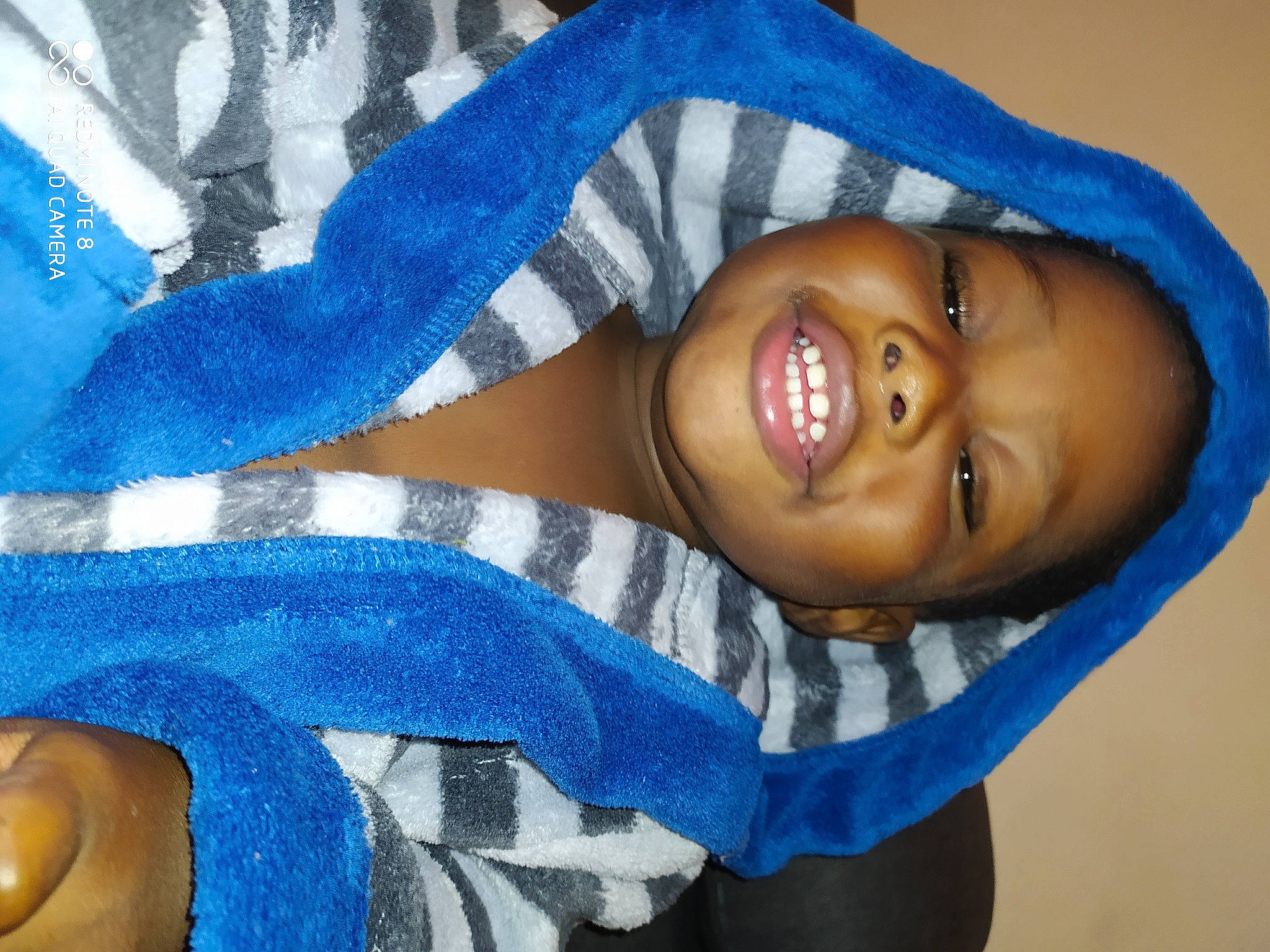 Tayron a rejoint le concours — aidez-le/la à gagner de superbes lots ! arm, azure, blue, comfort, eye, eyebrow, eyelash, finger, hair, happy, headgear, human_body, iris, joy, lip, mouth, neck, person, product, skin