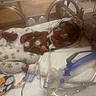 baby, bed, care, cartoon_prints, cute, fragile, healthcare, hospital, incubator, infant, medical_equipment, monitoring, newborn, onesie, patient, premature, sensors, sleeping, tube, wires