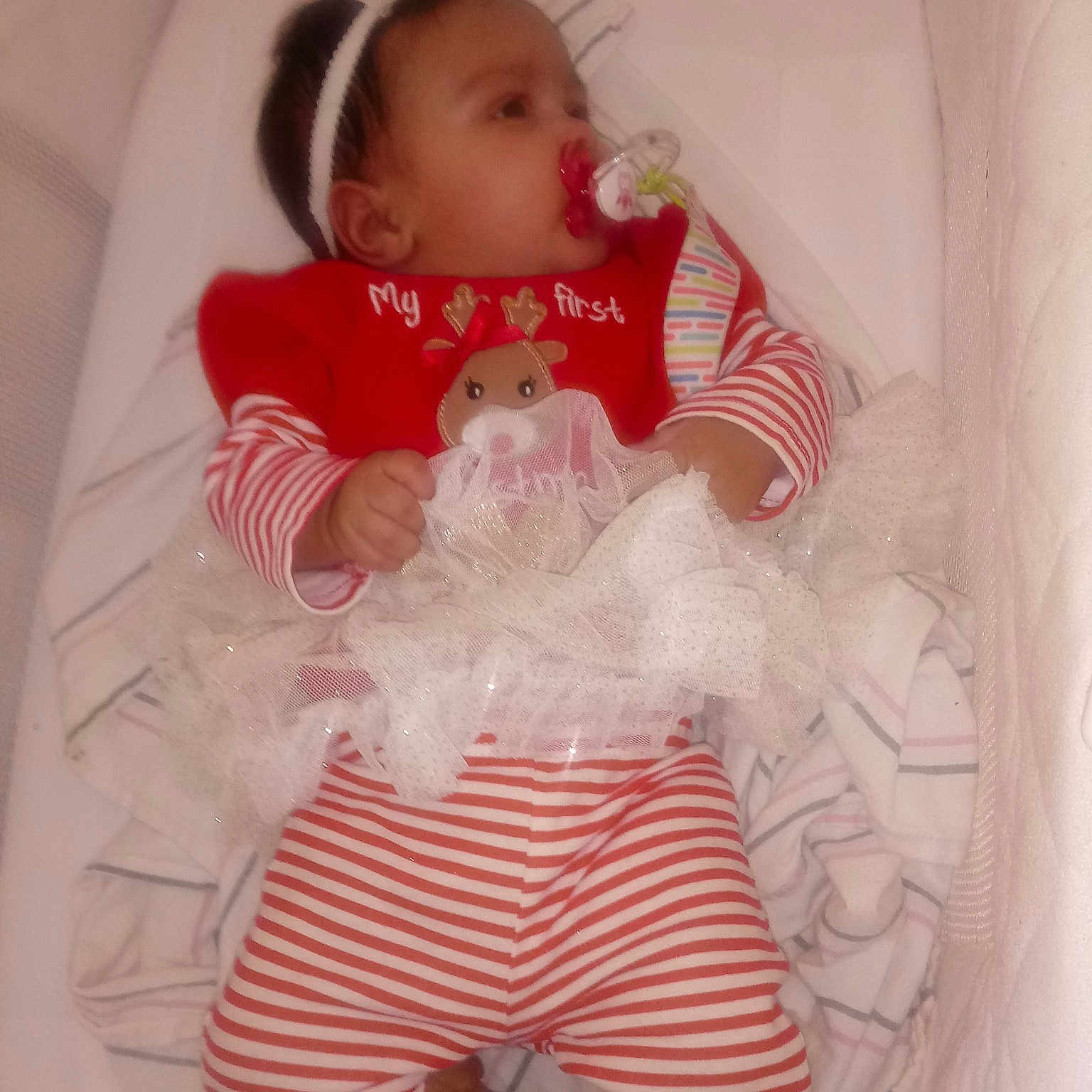 Charlene is registered to the contest to win money with this photo: baby_products, cheek, child, doll, finger, girl, hair_accessory, human_hair_color, infant, iris, mouth, person, pink, product, red, skin, textile, toddler