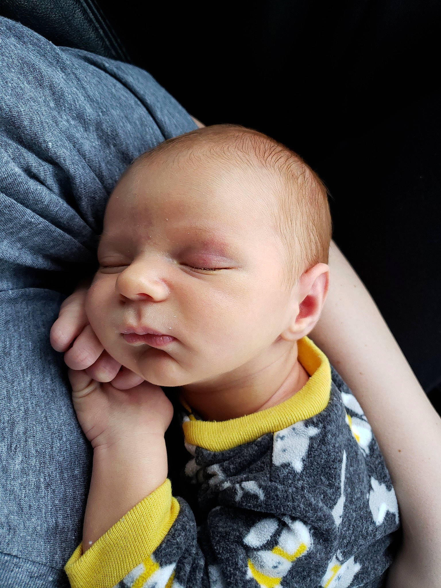 Aydean is registered to the contest to win money with this photo: baby, cheek, child, chin, ear, face, finger, hand, head, lip, mouth, neck, nose, person, skin, sleep, toddler, yellow