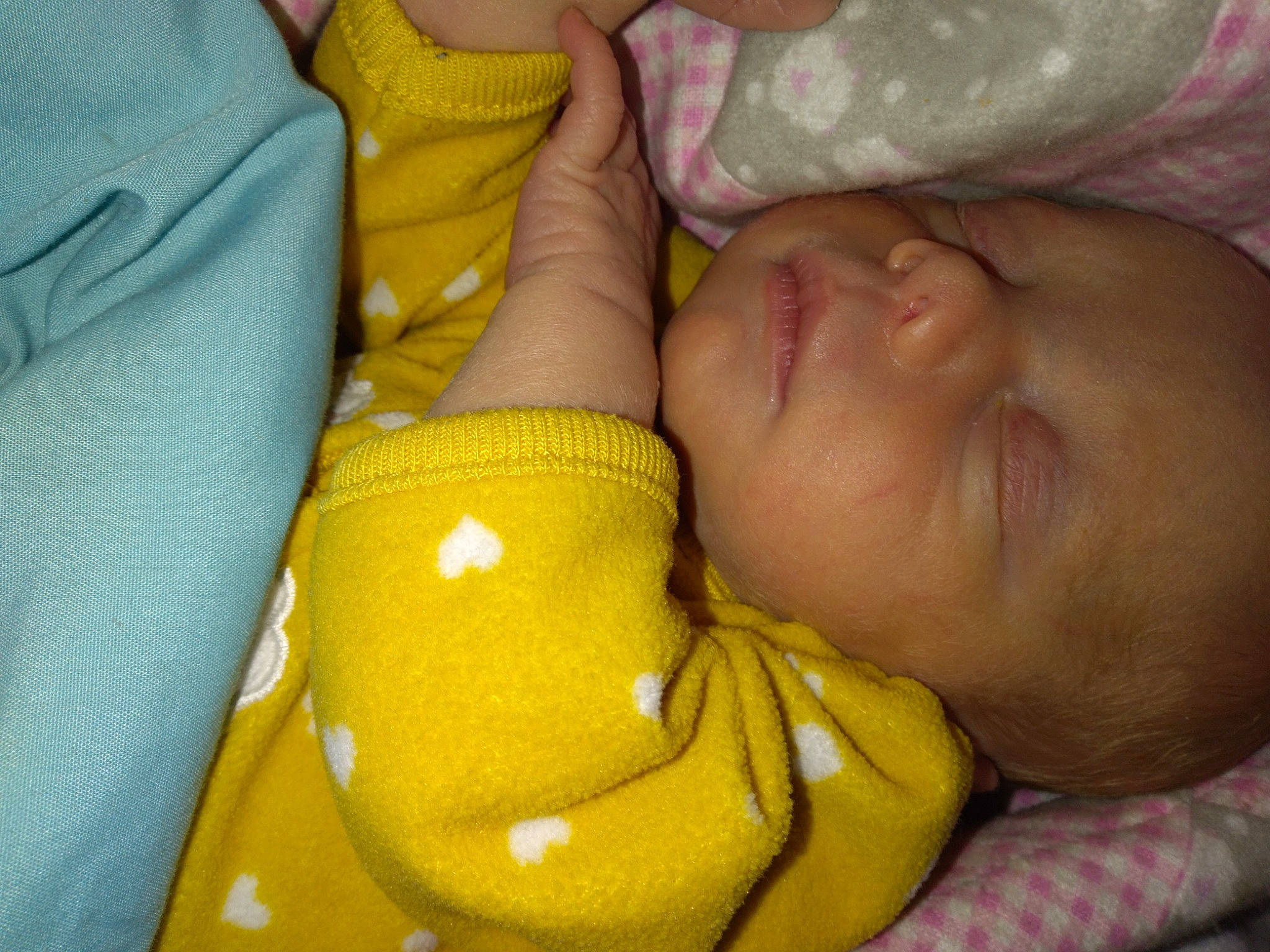 Allison is registered to the contest to win money with this photo: abdomen, baby, baby_toddler_clothing, cheek, chest, child, comfort, finger, foot, fun, human_leg, knee, mouth, nail, pattern, person, skin, thigh, thumb, toddler