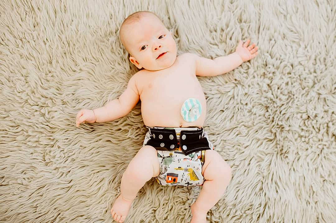 Leonidas is registered to the contest to win money with this photo: abdomen, baby, baby_toddler_clothing, barefoot, chest, fawn, flash_photography, grass, happy, human_body, people_in_nature, person, shorts, shoulder, skin, stomach, thigh, toddler, toy, trunk