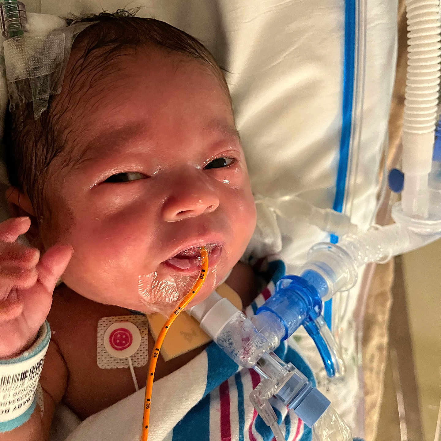 Kaizlyn joined the competition — help win amazing prizes! newborn, baby, hospital, medical_tubes, blanket, face, infant, monitor, hospital_wristband, bed, healthcare, patient, medical_equipment, cute, person, child, lying_down, indoors, closeup, vital_signs