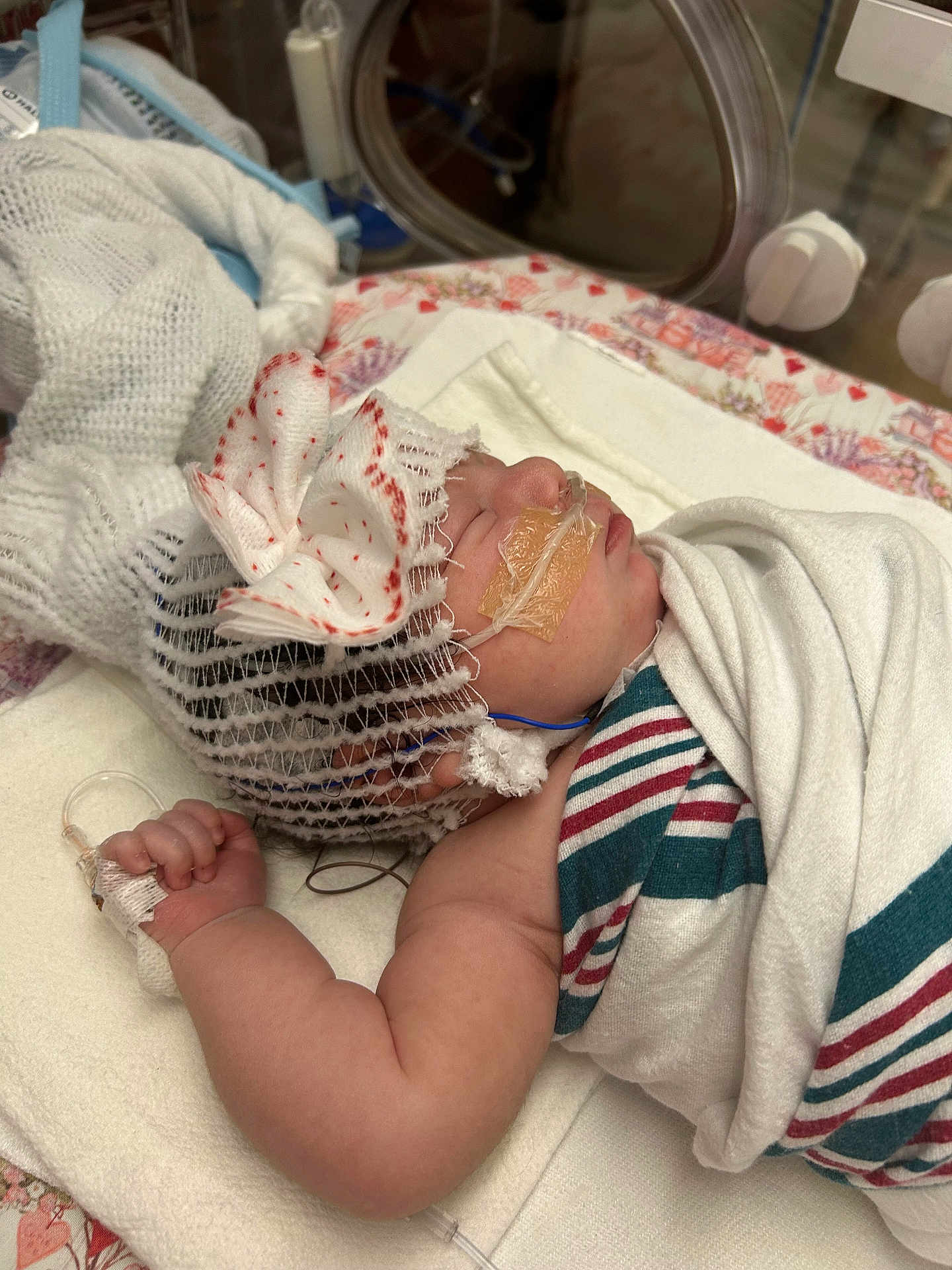 Gabriella is registered to the contest to win money with this photo: newborn, baby, hospital, blanket, cap, bow, medical_tube, sleeping, infant, bed, healthcare, patient, wrapped, cute, child, person, closeup, soft, peaceful, indoors
