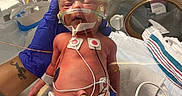 Allie is registered to the contest to win money with this photo: newborn, baby, hospital, incubator, medical_equipment, gloves, tattoo, oxygen_cannula, monitoring_sensors, diaper, wires, neonatal_care, person, infant, bed, healthcare, clinic, hand, care, patient