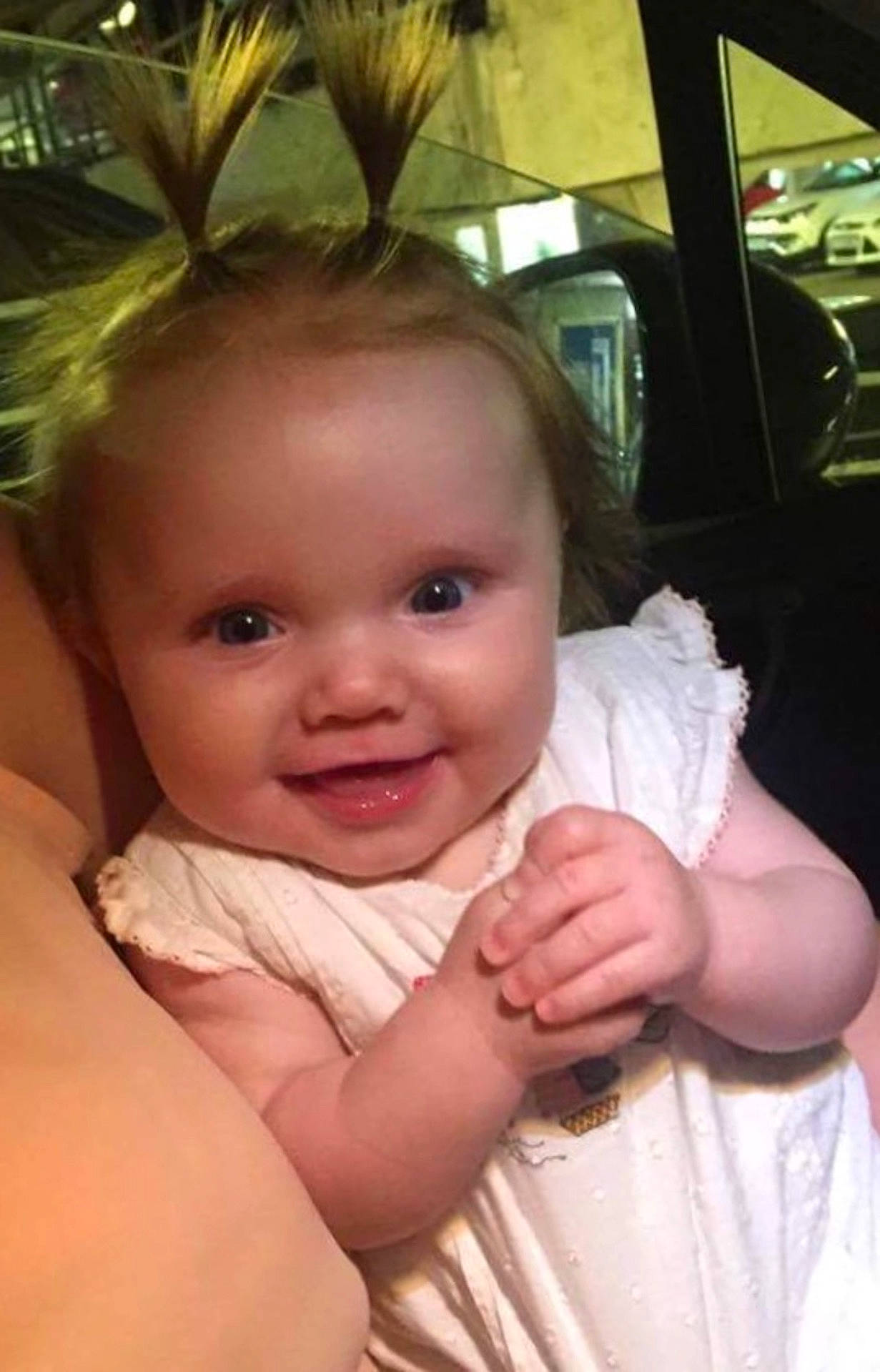 Larissa joined the competition — help win amazing prizes! cheek, child, child_model, ear, face, finger, girl, head, human_hair_color, infant, iris, joy, mouth, nose, skin, smile, toddler