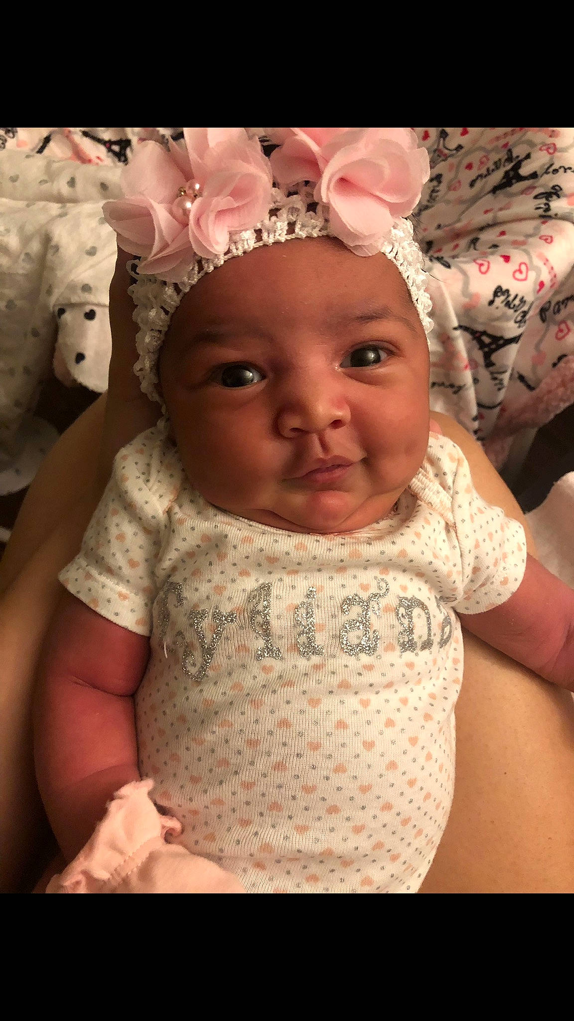 Tyliana joined the competition — help win amazing prizes! baby, cheek, child, face, forehead, hair_accessory, head, headband, headgear, headwear, lip, nose, person, pink, skin, smile, toddler