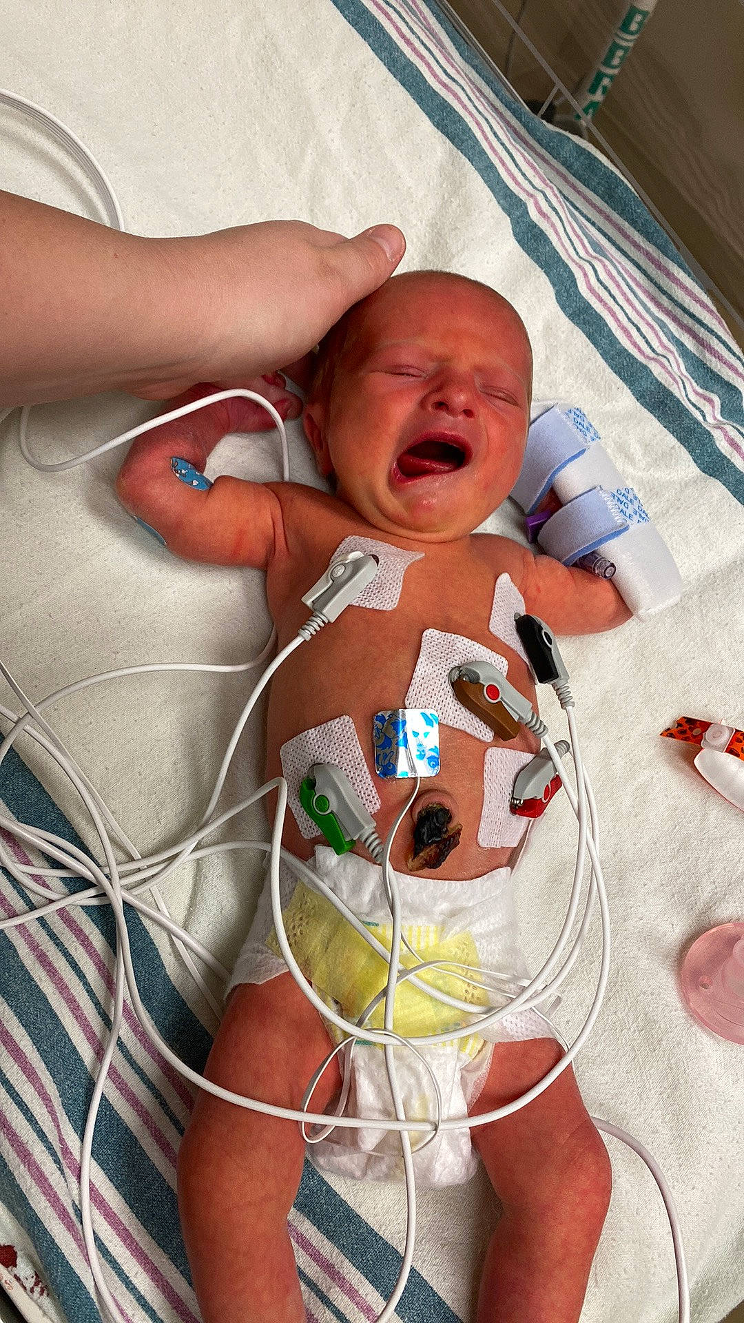 Madilynn joined the competition — help win amazing prizes! abdomen, baby, baby_products, chest, child, comfort, event, hospital, linens, medical, medical_equipment, medical_procedure, patient, pediatrics, person, room, skin, stethoscope, stomach, toddler