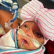 Nalani is registered to the contest to win money with this photo: baby, blanket, bow_hat, care, close_up, cute, eyes, face, healthcare, hospital, infant, lying_down, medical_equipment, mouth, newborn, oxygen_tube, person, skin, striped, wrapped