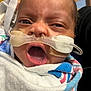 Nalani joined the competition — help win amazing prizes! baby, blanket, close_up, crying, expression, eyes, face, healthcare, hospital, human, infant, medical, mouth_open, nasal_cannula, newborn, oxygen_tube, patient, person, skin, wrapped