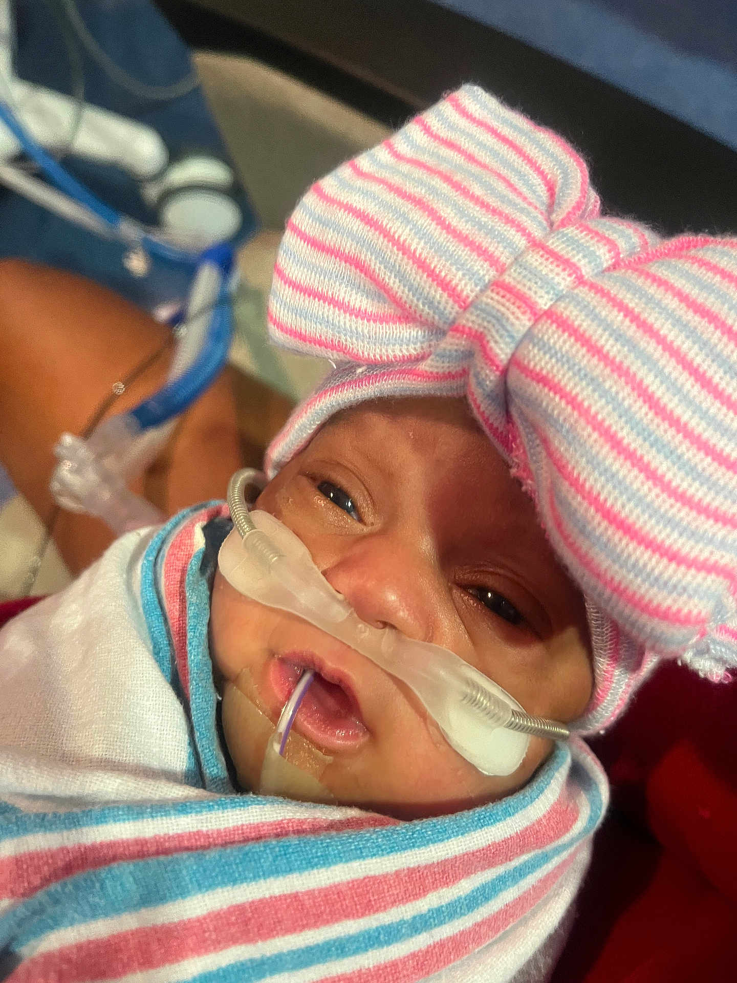 Nalani joined the competition — help win amazing prizes! newborn, baby, hospital, medical_tubes, nasal_cannula, blanket, striped, bow_hat, infant, face, wrapped, care, patient, closeup, sleepy, cute, child, healthcare, person, portrait